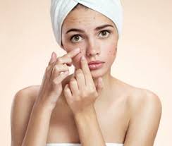 Acne Treatment in Estero & Naples, FL