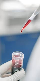 Western Blotting (Immunoblotting) Services | Precision for Medicine