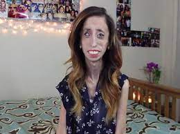 Alors âgée de 17 ans, lizzie tombe par hasard sur une vidéo intitulée la femme la plus laide du monde. Video Lizzie Velasquez La Femme La Plus Laide Du Monde Dans Un Documentaire News Levif Weekend