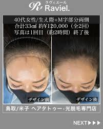 毛穴エステ､ヘアタトゥーRaviel.ラヴィエール