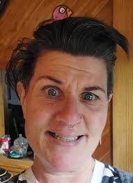 Aaron getting his cast