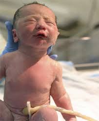 Maternal Anesthesia: What are the Effects