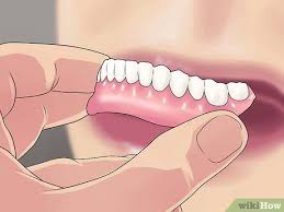 It would help if you were using a specialized denture cleaner, baking soda, or vinegar to remove stains. 7 Tips To Remove Denture Adhesive From Gums Wikihow