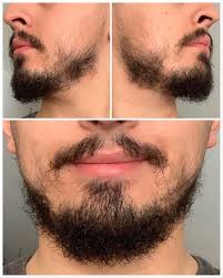 Pin On Beard Growth