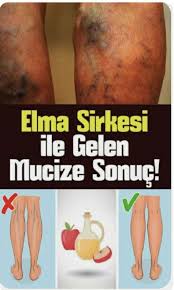 Pin By Irem Vatansever On Cilt Bakimi Health Health Fitness Pharmacology