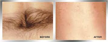 It's worth talking to a doctor about counselling before you hit up a surgeon. Cosmetic Face And Body Treatments For Men In Washington Dc