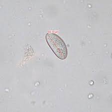 Maybe you would like to learn more about one of these? Cdc Dpdx Enterobiasis