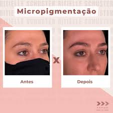 Ritielle Schuster Clínica Estética