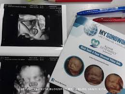 Pakej Ultrasound Scan Menarik Di Klinik Myfamily Janji Kita