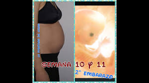 Aquí encontrarás información detallada de cada una de durante las primeras semanas de embarazo tu cuerpo comenzará a sufrir algunos cambios importantes. Nauseas Malestares Y Barriga Semana 10 Y 11 De Embarazo Youtube