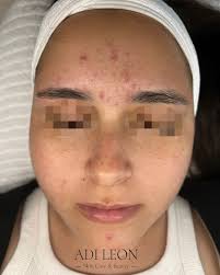 פותחים את השבוע בעוד ניצחון של האקנה!! 🙌🏼 לפרטים ולייעוץ 053-3507120 📱