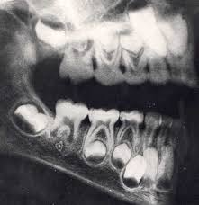 Teeth Dental Hygenist Dental Dental Assistant