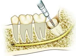 Saat ini banyak obat yang beredar di pasaran dan bisa digunakan untuk mengatasi gusi bengkak, anda sebaiknya pintar memilih dan. Penyebab Dan Cara Menyembuhkan Gusi Belakang Bengkak