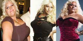 Dog with his late wife beth. Beth Chapman Plastic Surgery Before And After Pictures 2021