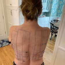 Image result for Patch Testing