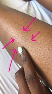 The day of your appointment, your hair should be at least a ¼ inch long (the length of a rice grain). I Didn T Shave My Legs For A Month To See If This Painless Wax Was Actually Painless