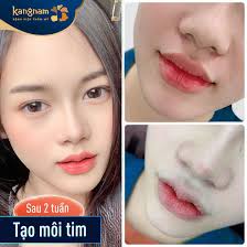 Cách cắt môi trái tim diễn ra như thế nào?