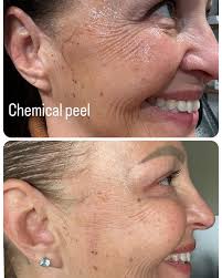 isacaring4u #PreventiveCare #HealthForAll #Hospice #SelfCare  #caringfortheelderly #CaringForTheSick#viral#wellness #kindness #Wellness  #Caring