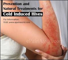 Pin On Skin Diseases