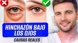 Tener la Piel que siempre quisiste, es posible. ✨