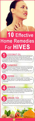 10 Effective Home Remedies For Hives Home Remedies For Hives Hives Remedies Allergy Remedies