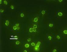 Cryptosporidium parvum is one of several protozoal species that cause cryptosporidiosis, a parasitic disease of the mammalian intestinal tract. Cryptosporidium Parvum Wikipedia