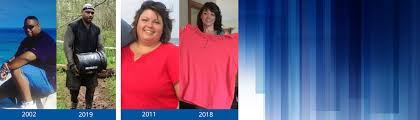 Check spelling or type a new query. Weight Loss Surgery Before And After Photos Before And After Photos Duke Health