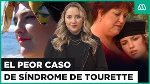 El tiktoker con síndrome de Tourette que usa las redes para mostrar cómo es  vivir con esa enfermedad