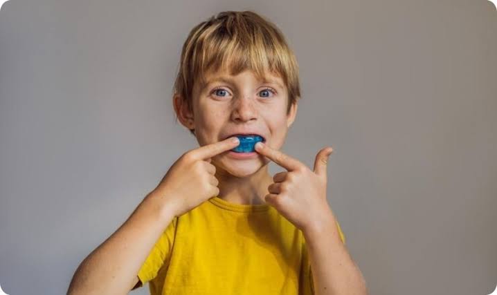 Kids' Sports Mouthguards: A Parent's Essential Guide
