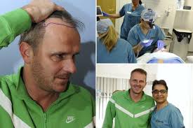 haartransplantation forum