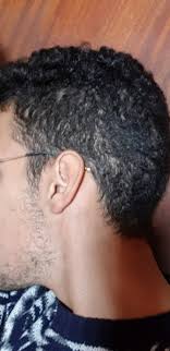 They are designed for easily the benchmark for minoxidil hair loss products that is backed by a solid brand and years of. My Hair Started Shedding 2 Weeks After Minoxidil Use Is This Normal Or At Least Is It Temporary And For How Long Will The Hair Shedding Last Minoxbeards