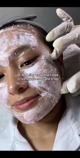 Hifu Before and After Kl