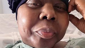 Fundraiser by Latoya Spencer : Life after stemcell transplant