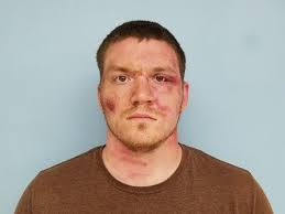 TURNER: The silence that cried loudest