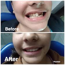 Uncover why apex dental care is the best company for you. Apex Dental Care And Implant Centre Udhampur Home Facebook