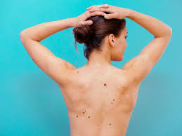 Learn about the academy's efforts to refocus its brand on education. 10 Signs Of Skin Cancer You Shouldn T Ignore Self