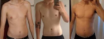 En effet, perdre du poids n'est pas toujours une garantie d'un résultat probant et surtout à long terme. Maigre Mais Gras Skinny Fat Megagear