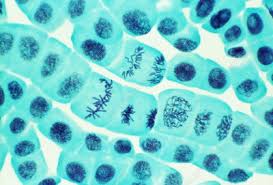 Check spelling or type a new query. Plant Cell Mitosis Light Micrograph Stock Image B215 0056 Science Photo Library