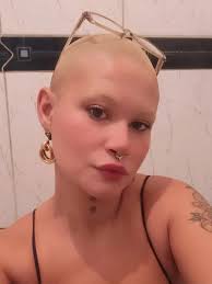 I am a bald Nigeria based model woman. Yes, we exist, but I do not blame  you for not knowing that. We are unseen and rendered invisible.We have  confidence and boldness. @gray_africana #