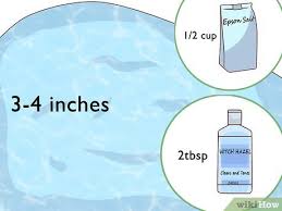 How to use witch hazel on your skin. 3 Ways To Use Witch Hazel To Reduce Hemorrhoids Wikihow