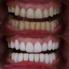 Dr. Gabor Tamas Pinter Md Dmd