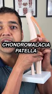 Knee Injury Chondromalacia Patella