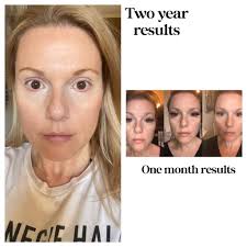 Should you wash your face daily for clear skin?