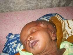 Photo Baby Boy Born With 3 Functional Eyes In Kano Flatimes