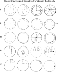 Hands must be centered within the clock face with their junction close to the clock center. The Test Of Time A History Of Clock Drawing Hazan 2018 International Journal Of Geriatric Psychiatry Wiley Online Library