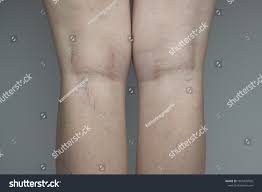9 Kneepit Images, Stock Photos & Vectors | Shutterstock