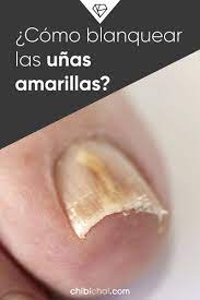 Como Blanquear Las Unas Amarillas Como Blanquear Las Unas Blanquear Las Unas Unas Amarillas