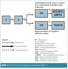 Image result for Transient Global Amnesia