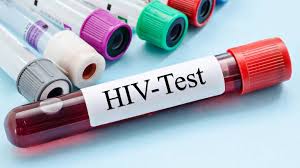 Wann ist es sinnvoll sich testen zu lassen? 19 5 1987 In Bayern Wird Ein Aids Test Fur Homosexuelle Angeordnet Swr2