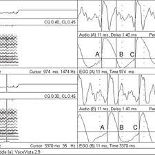 We did not find results for: Display In Vocevista Of A Sustained F4 349 Hz Vowel A With An Download Scientific Diagram